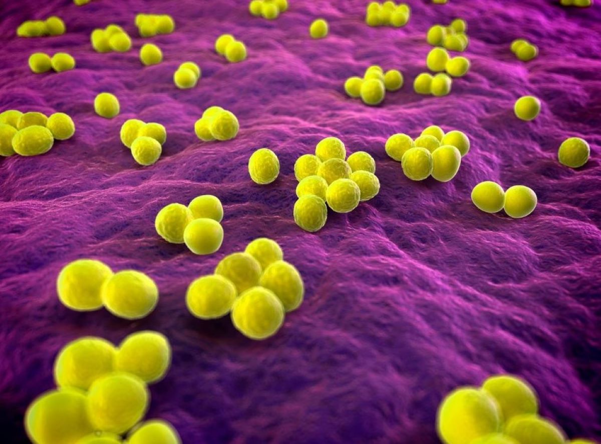 Baktérie MRSA. Počítačové znázornenie baktérie Staphylococcus aureus (MRSA)